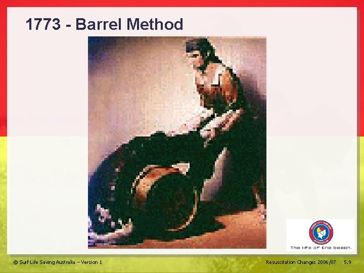 1773 - Barrel Method © Surf Life Saving Australia – Version 1 Resuscitation Changes