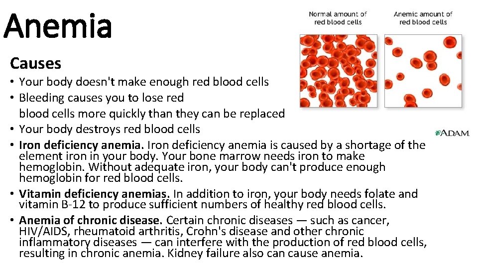 Anemia Causes • Your body doesn't make enough red blood cells • Bleeding causes