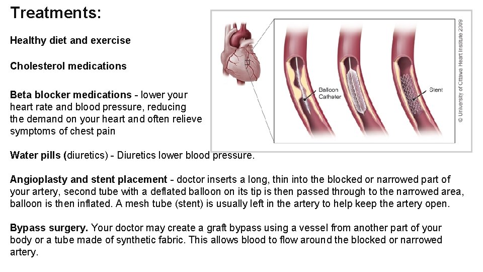 Treatments: Healthy diet and exercise Cholesterol medications Beta blocker medications - lower your heart