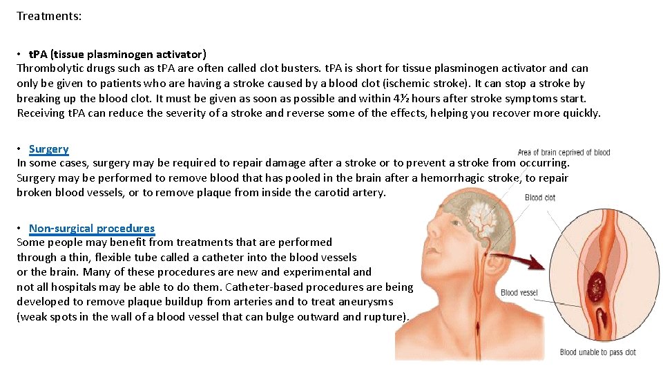 Treatments: • t. PA (tissue plasminogen activator) Thrombolytic drugs such as t. PA are