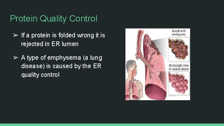 Protein Quality Control ➢ If a protein is folded wrong it is rejected in