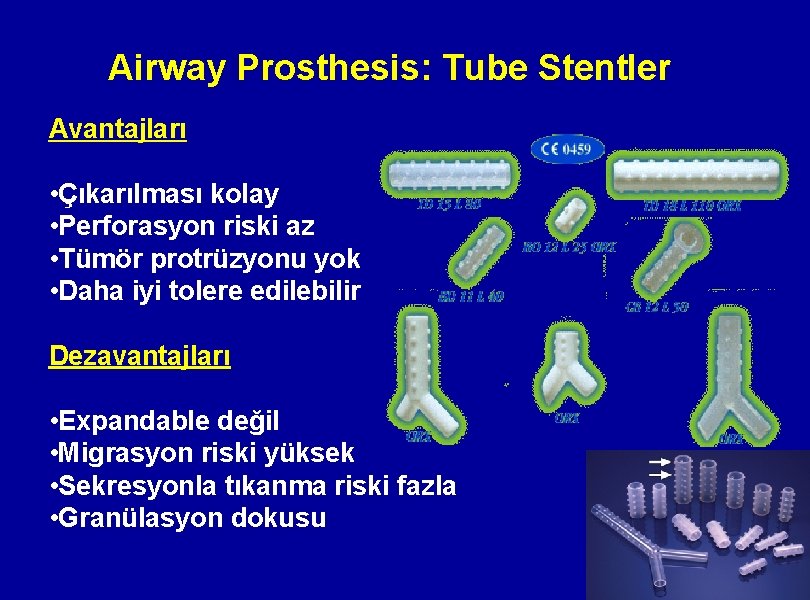 Airway Prosthesis: Tube Stentler Avantajları • Çıkarılması kolay • Perforasyon riski az • Tümör