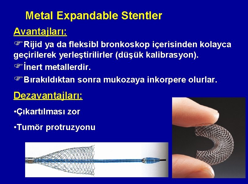 Metal Expandable Stentler Avantajları: FRijid ya da fleksibl bronkoskop içerisinden kolayca geçirilerek yerleştirilirler (düşük