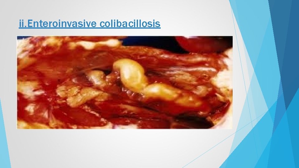 ii. Enteroinvasive colibacillosis 