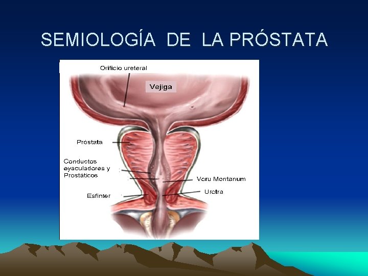 SEMIOLOGÍA DE LA PRÓSTATA 