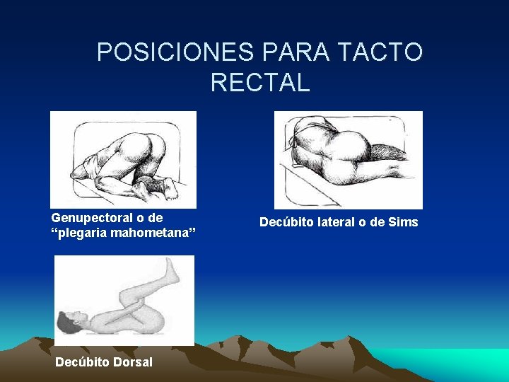 POSICIONES PARA TACTO RECTAL Genupectoral o de ‘‘plegaria mahometana’’ Decúbito Dorsal Decúbito lateral o