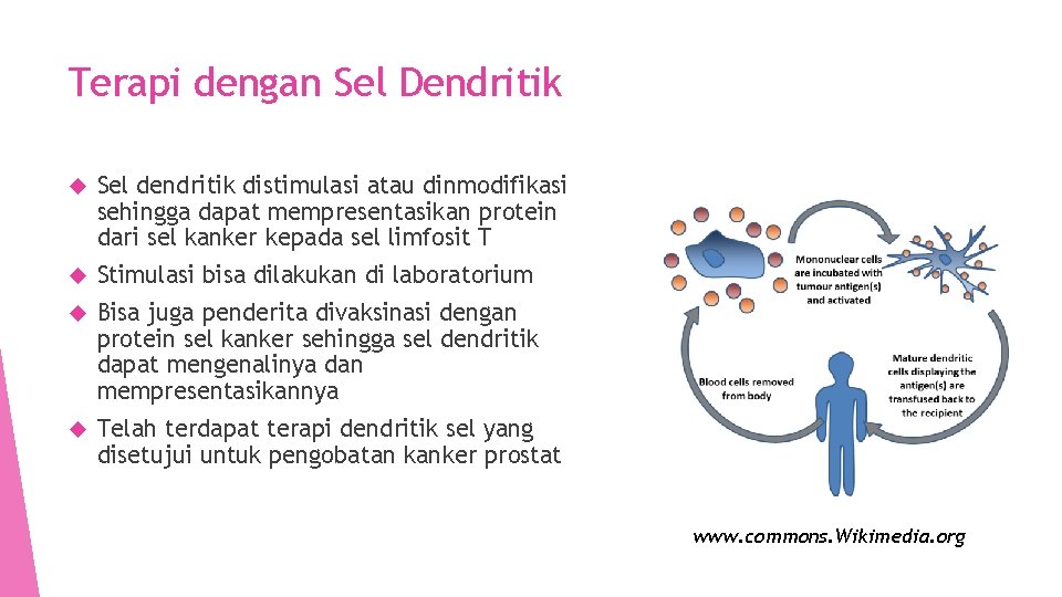 Terapi dengan Sel Dendritik Sel dendritik distimulasi atau dinmodifikasi sehingga dapat mempresentasikan protein dari