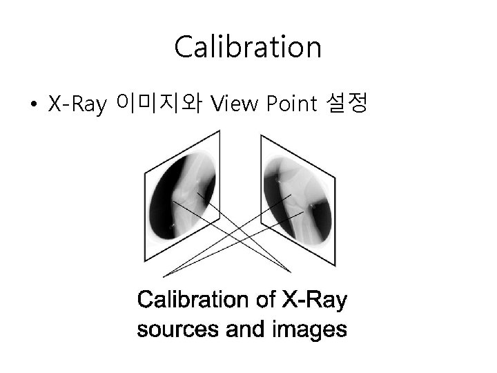 Calibration • X-Ray 이미지와 View Point 설정 