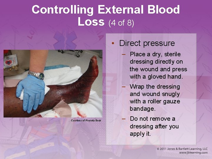 Controlling External Blood Loss (4 of 8) • Direct pressure – Place a dry,