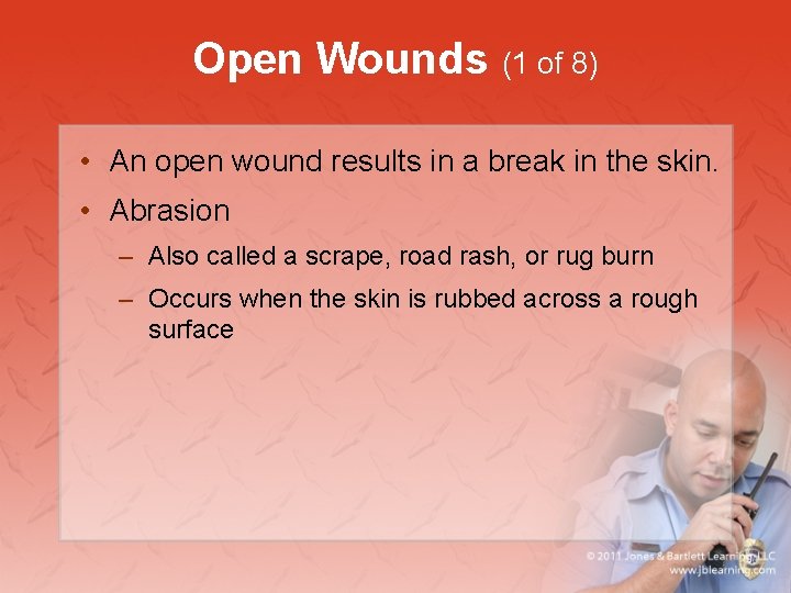 Open Wounds (1 of 8) • An open wound results in a break in