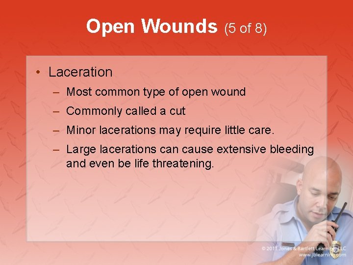 Open Wounds (5 of 8) • Laceration – Most common type of open wound