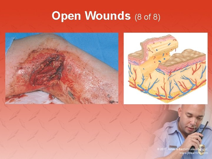 Open Wounds (8 of 8) 