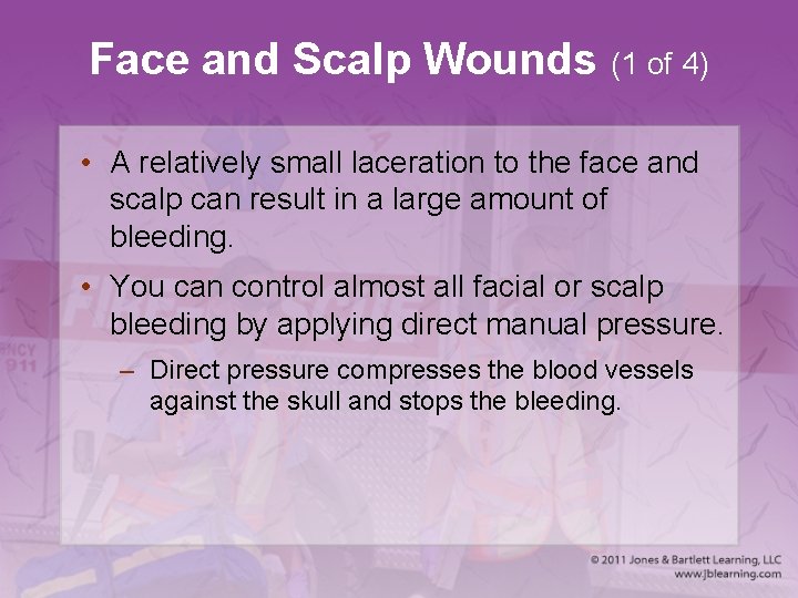 Face and Scalp Wounds (1 of 4) • A relatively small laceration to the