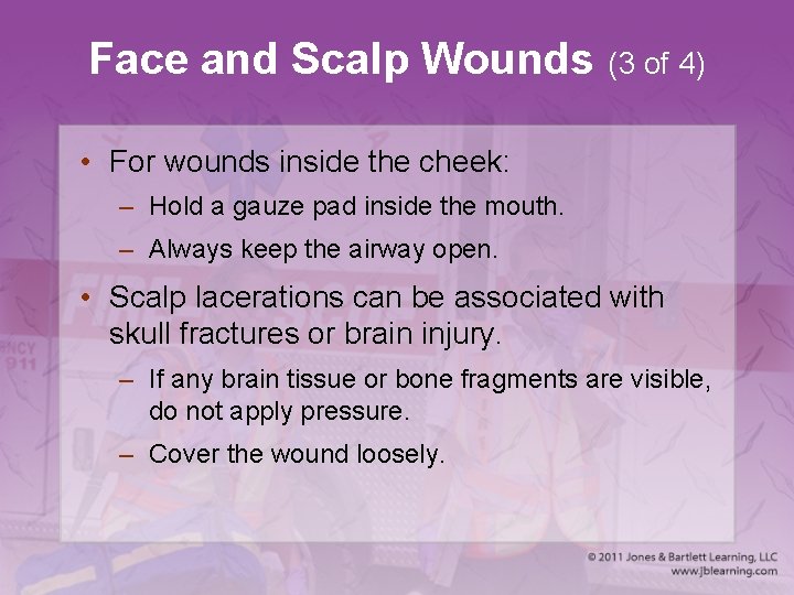 Face and Scalp Wounds (3 of 4) • For wounds inside the cheek: –
