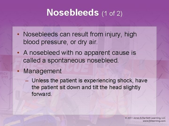 Nosebleeds (1 of 2) • Nosebleeds can result from injury, high blood pressure, or