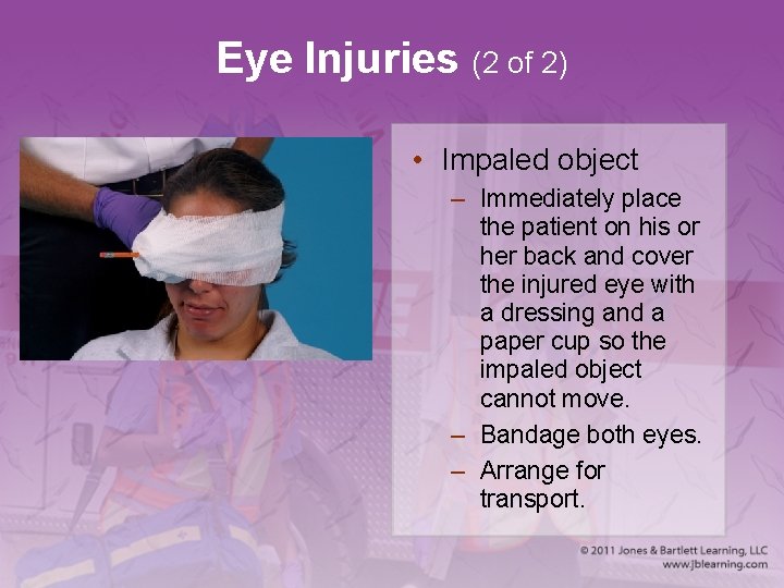 Eye Injuries (2 of 2) • Impaled object – Immediately place the patient on