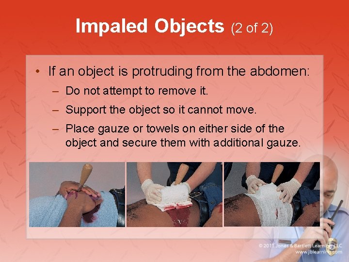 Impaled Objects (2 of 2) • If an object is protruding from the abdomen: