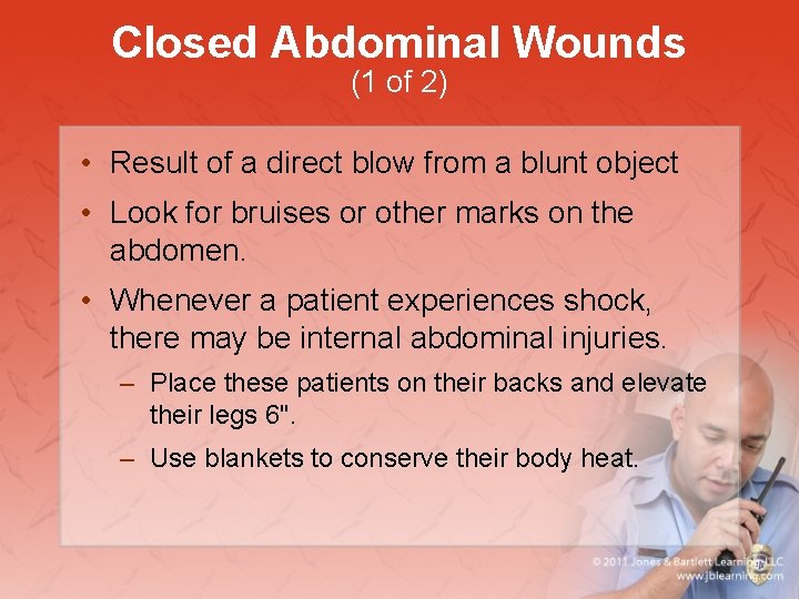 Closed Abdominal Wounds (1 of 2) • Result of a direct blow from a