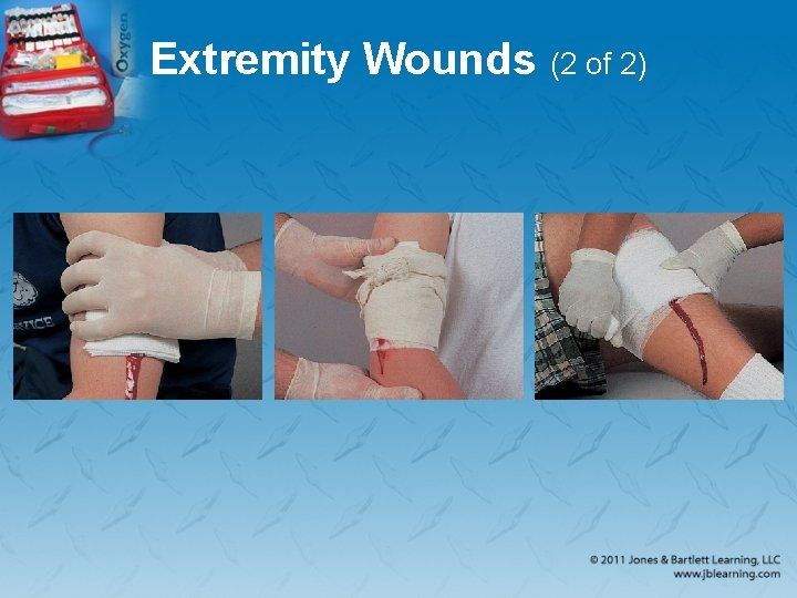 Extremity Wounds (2 of 2) 