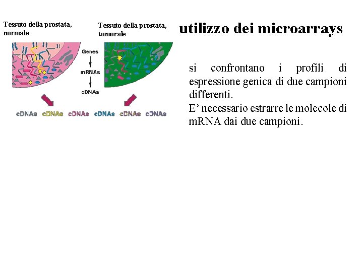 Tessuto della prostata, normale Tessuto della prostata, tumorale utilizzo dei microarrays si confrontano i