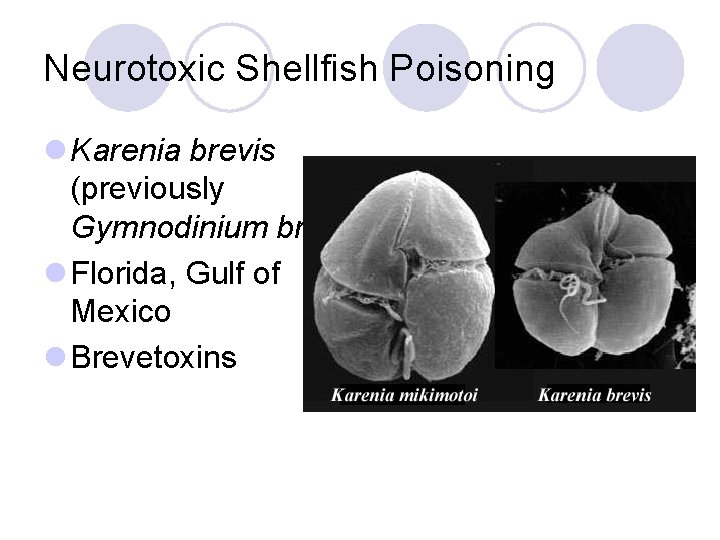 Neurotoxic Shellfish Poisoning l Karenia brevis (previously Gymnodinium breve) l Florida, Gulf of Mexico