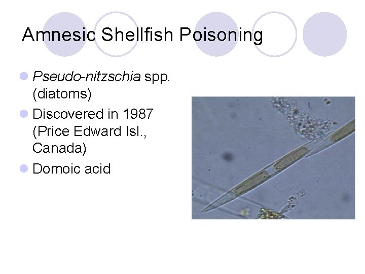 Amnesic Shellfish Poisoning l Pseudo-nitzschia spp. (diatoms) l Discovered in 1987 (Price Edward Isl.