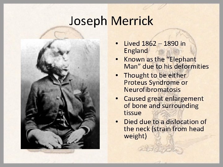 Joseph Merrick • Lived 1862 – 1890 in England • Known as the “Elephant