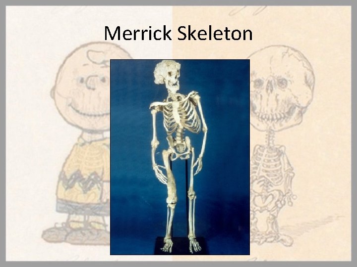 Merrick Skeleton 