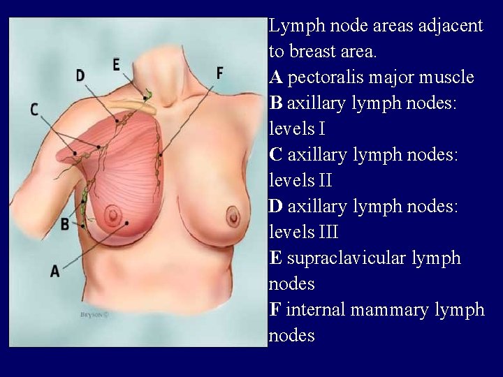 Lymph node areas adjacent to breast area. A pectoralis major muscle B axillary lymph