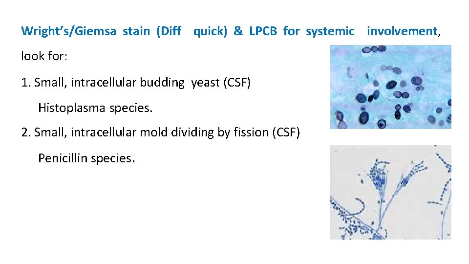 Wright’s/Giemsa stain (Diff quick) & LPCB for systemic involvement, look for: 1. Small, intracellular
