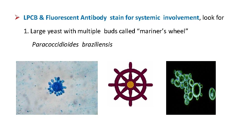  LPCB & Fluorescent Antibody stain for systemic involvement, look for 1. Large yeast