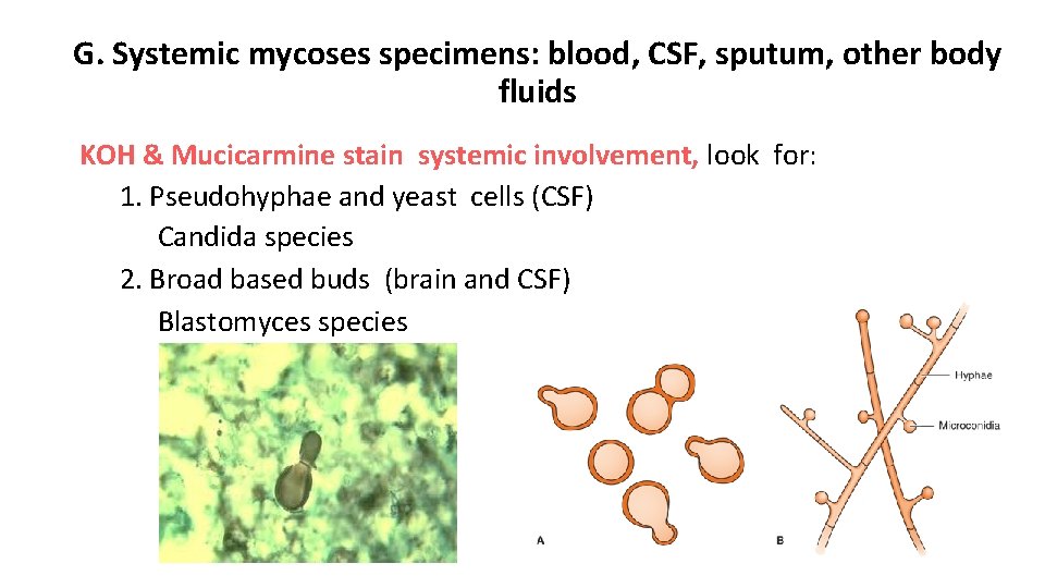 G. Systemic mycoses specimens: blood, CSF, sputum, other body fluids KOH & Mucicarmine stain