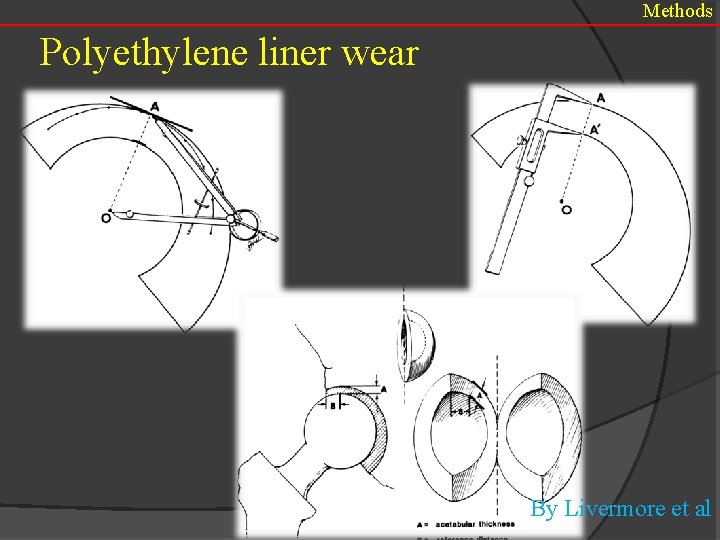 Methods Polyethylene liner wear By Livermore et al 