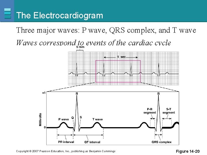 The Electrocardiogram Three major waves: P wave, QRS complex, and T wave Waves correspond