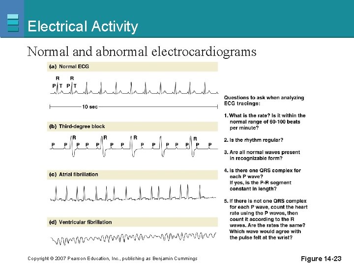 Electrical Activity Normal and abnormal electrocardiograms Copyright © 2007 Pearson Education, Inc. , publishing