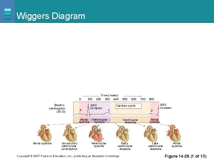 Wiggers Diagram 0 Electrocardiogram (ECG) P 100 Time (msec) 200 300 400 QRS complex