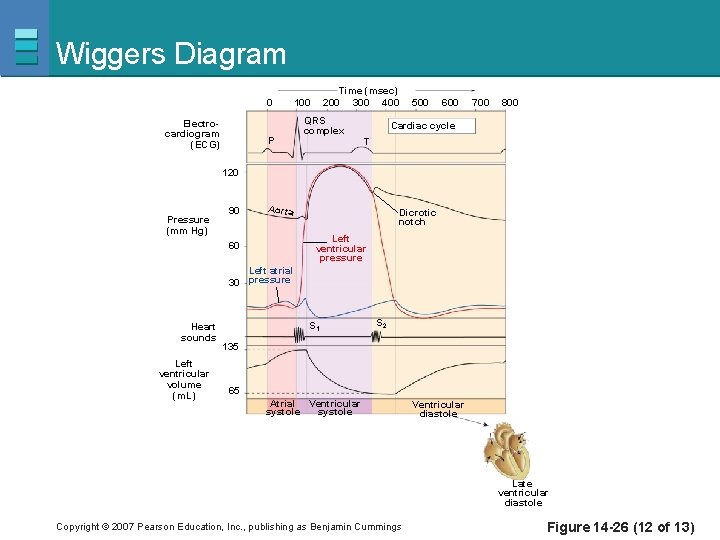 Wiggers Diagram 0 Electrocardiogram (ECG) P Time (msec) 200 300 400 100 QRS complex
