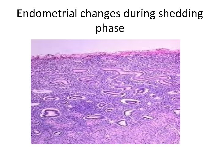 Endometrial changes during shedding phase 