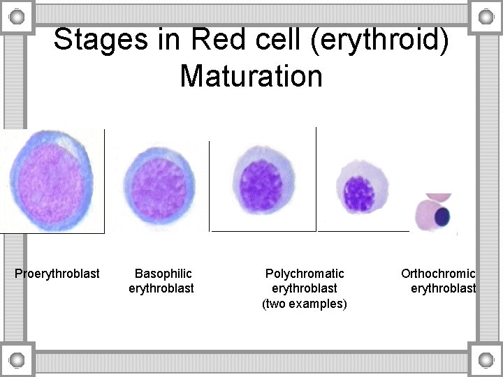 Stages in Red cell (erythroid) Maturation Proerythroblast Basophilic erythroblast Polychromatic erythroblast (two examples) Orthochromic