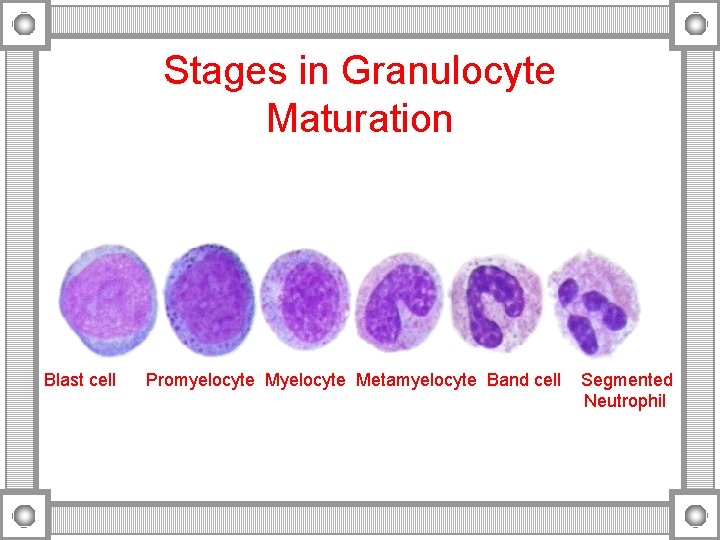 Stages in Granulocyte Maturation Blast cell Promyelocyte Metamyelocyte Band cell Segmented Neutrophil 