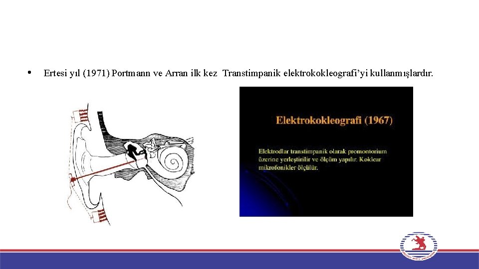  • Ertesi yıl (1971) Portmann ve Arran ilk kez Transtimpanik elektrokokleografi’yi kullanmışlardır. 