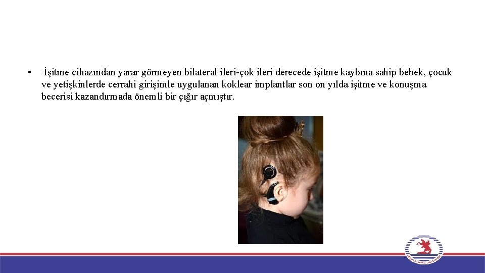  • İşitme cihazından yarar görmeyen bilateral ileri-çok ileri derecede işitme kaybına sahip bebek,