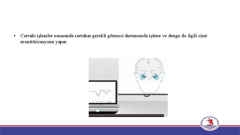  • Cerrahi işlemler esnasında cerrahın gerekli görmesi durumunda işitme ve denge ilgili sinir