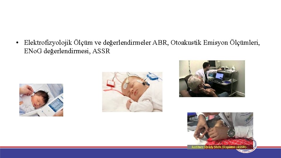  • Elektrofizyolojik Ölçüm ve değerlendirmeler ABR, Otoakustik Emisyon Ölçümleri, ENo. G değerlendirmesi, ASSR