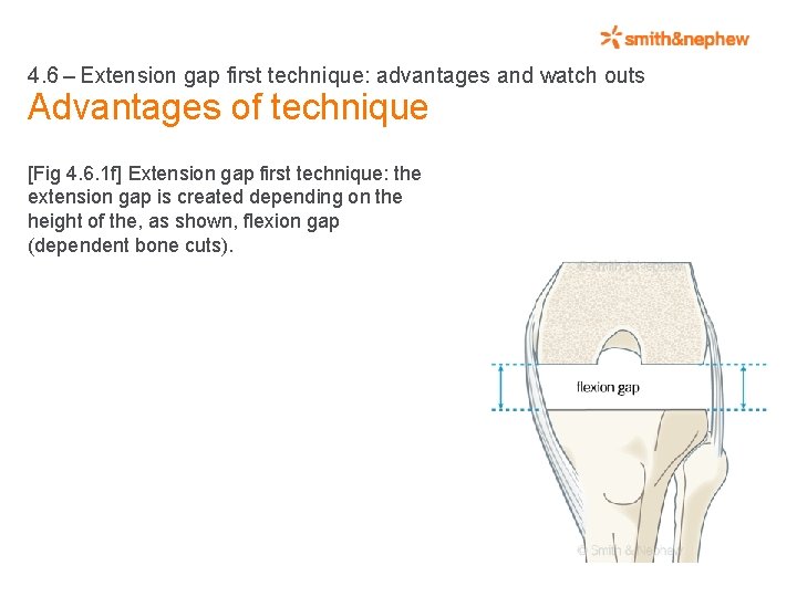 4. 6 – Extension gap first technique: advantages and watch outs Advantages of technique