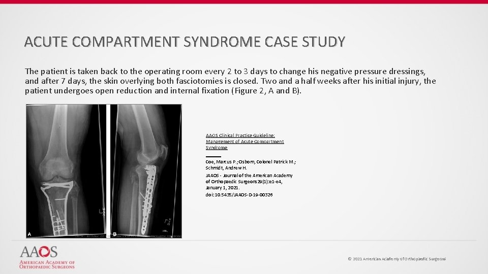 ACUTE COMPARTMENT SYNDROME CASE STUDY The patient is taken back to the operating room