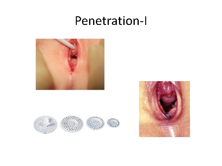 Penetration-I 