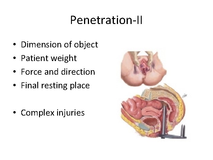 Penetration-II • • Dimension of object Patient weight Force and direction Final resting place