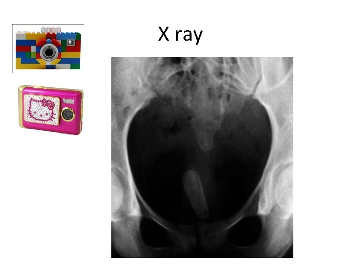 X ray 