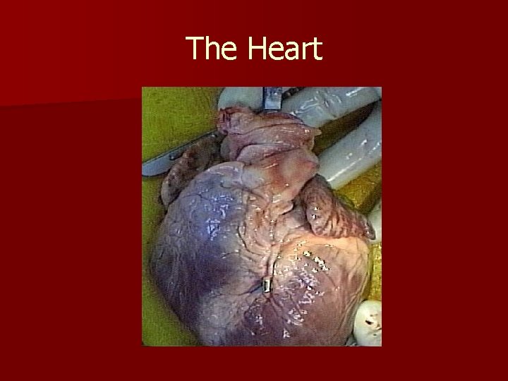 The Heart 